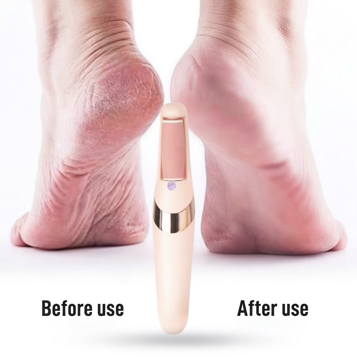 Electric Foot Callus Remover & Pedicure Tool